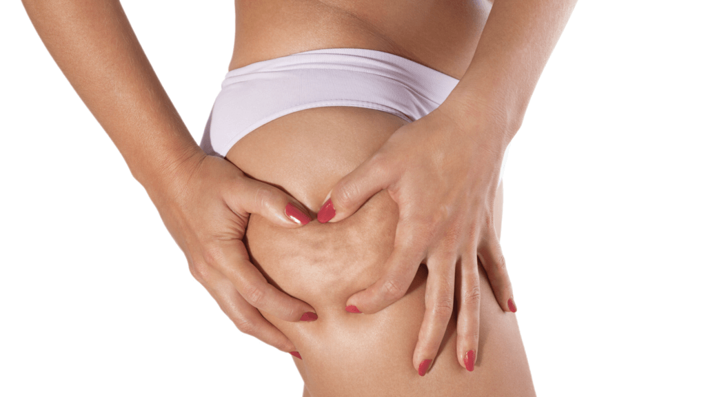 Wat is cellulite en hoe pak je het aan?l | Strak Plan online diëtisten